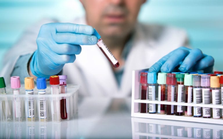 A scientist wearing blue gloves holds a blood sample test tube among multiple labeled vials in a laboratory setting.