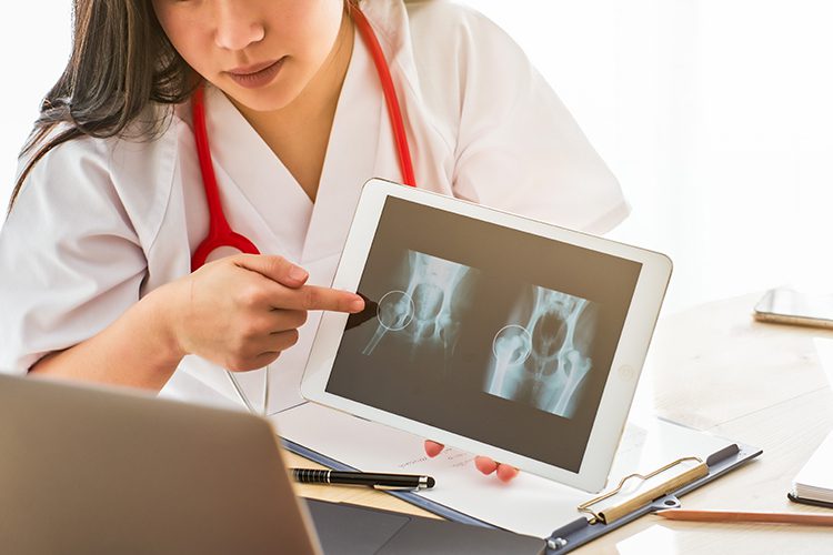A medical professional points to highlighted areas on a hip X-ray displayed on a tablet, with a stethoscope around her neck and a laptop nearby.