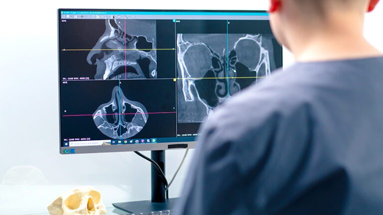 A person in medical scrubs views sinus and skull CT scan images on a computer monitor, with a model skull placed on the desk nearby.